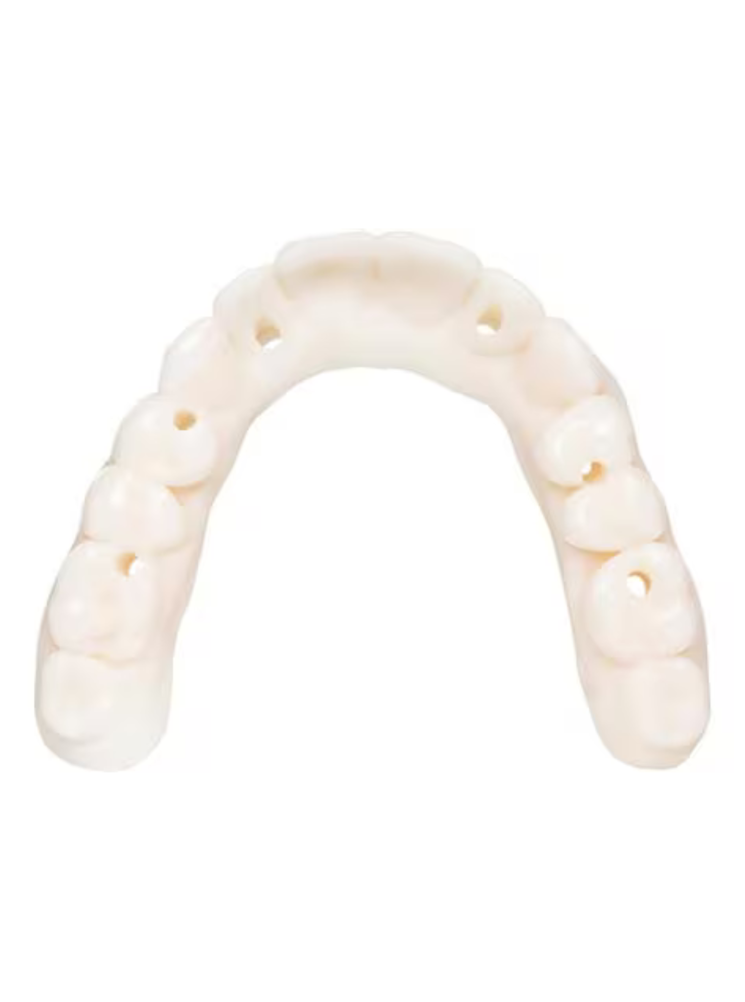 KeyDenture Try-In
