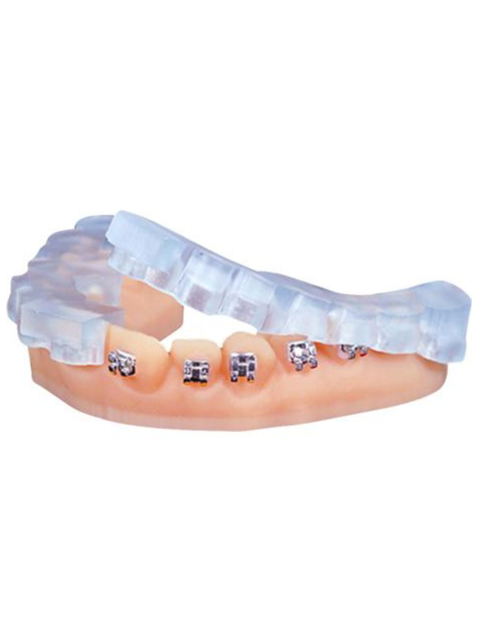 KeyOrtho IBT