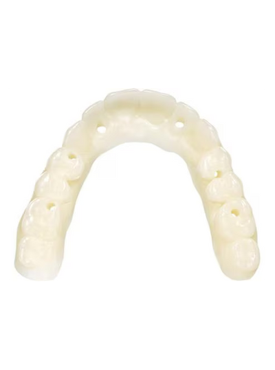 KeyDenture Try-In