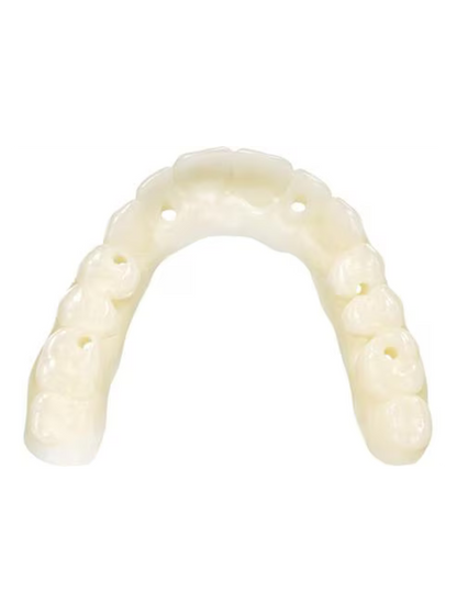 KeyDenture Try-In