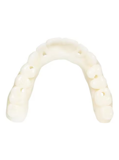 KeyDenture Try-In
