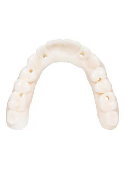 KeyDenture Try-In