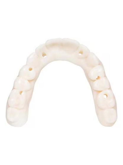 KeyDenture Try-In