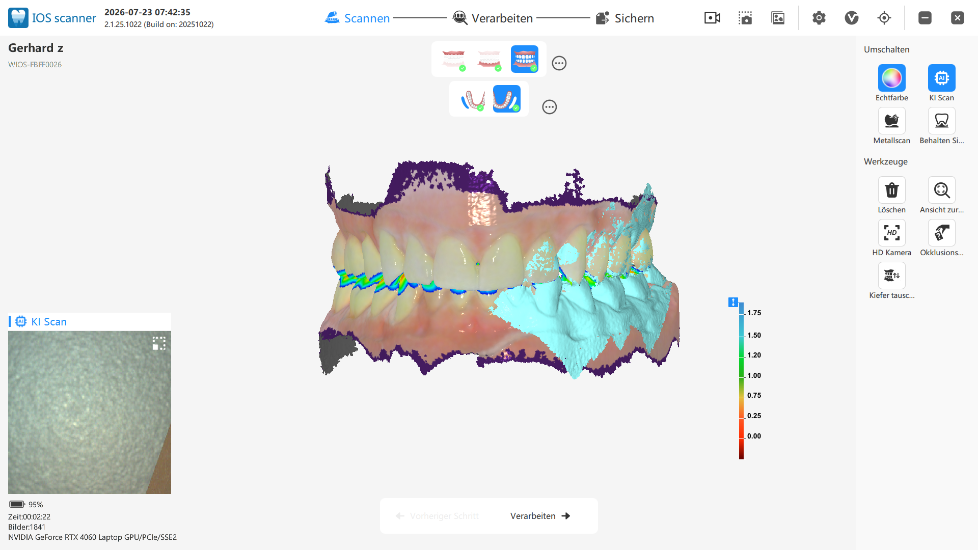 Schick DX Lite Scansoftware für digitalen Dental Workflow