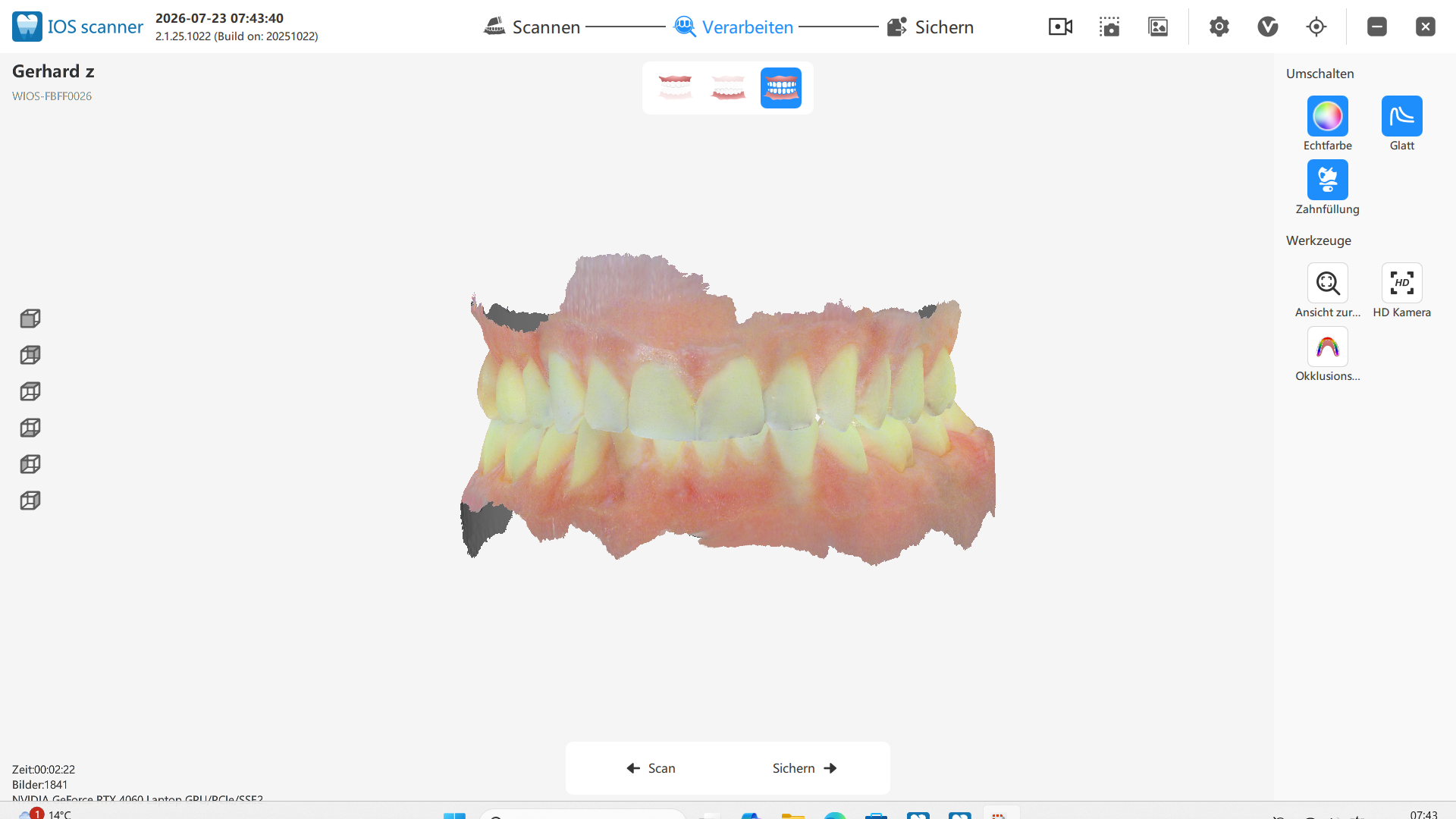 Schick DX Mobile Scansoftware für digitalen Dental Workflow