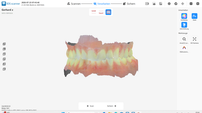 Schick DX Mobile Scansoftware für digitalen Dental Workflow